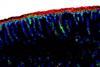 22_Foetal_intestine_vrijstaand_liggend