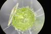 MIT-Microneedle-Delivery-02-press