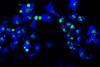 pyrenoids_2_Tanner Robison