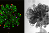 Triple reporter organoids