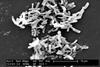 Clostridium_difficile_01
