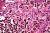 alveolar macrophages