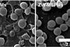 s.aureus