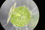 MIT-Microneedle-Delivery-02-press