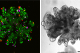 Triple reporter organoids