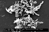 Clostridium_difficile_01