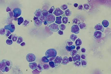 Leukaemia cells with the BIM variation