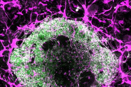Oscar-Abilez-organoid-blood-vessels