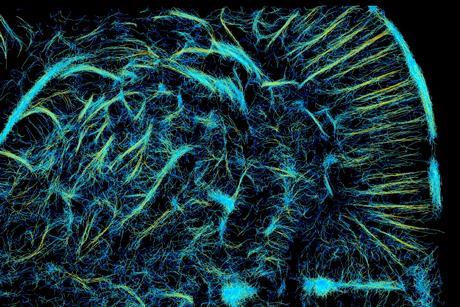braininvivo_klein