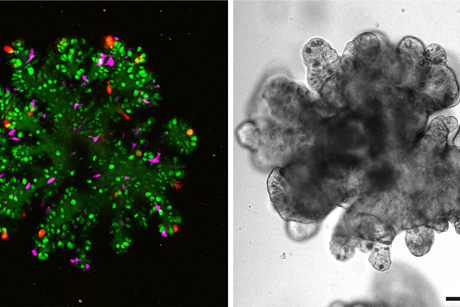 Triple reporter organoids