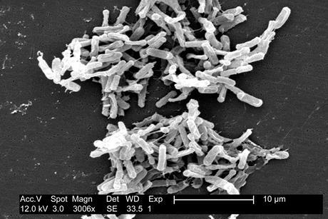 Clostridium_difficile_01