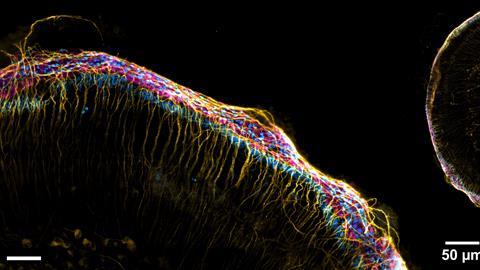 Foto 5. Cochlea (binnenoor) van een muis
