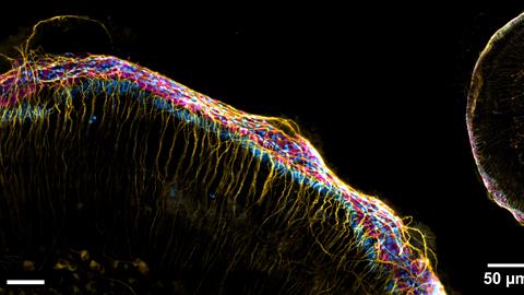 Foto 5. Cochlea (binnenoor) van een muis