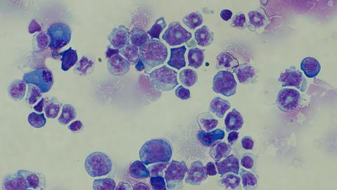 Leukaemia cells with the BIM variation