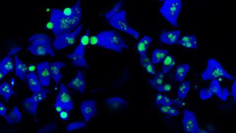 pyrenoids_2_Tanner Robison