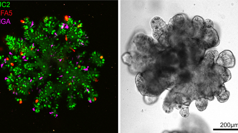 Triple reporter organoids