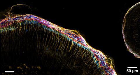 Foto 5. Cochlea (binnenoor) van een muis