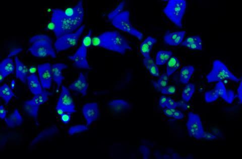 pyrenoids_2_Tanner Robison