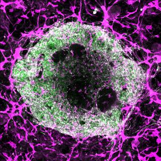 Oscar-Abilez-organoid-blood-vessels