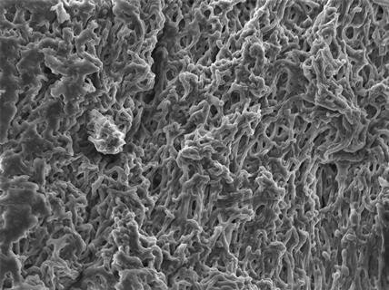 Mycelium netwerk (hyphae) - Scanning electron microscopy (SEM)