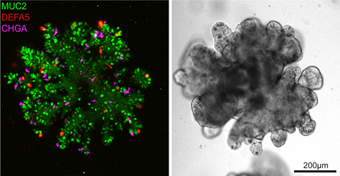 Triple reporter organoids