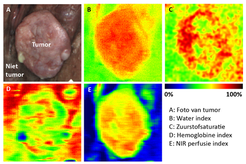 HSI data tumor-01