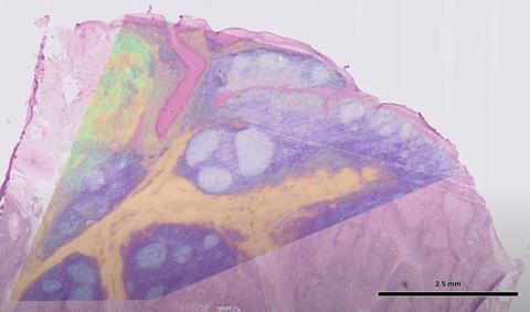 Microscopic image of human lymph node