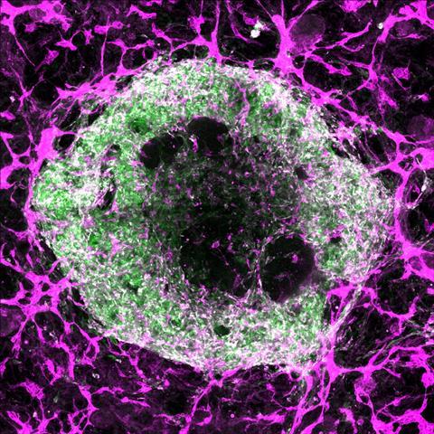 Oscar-Abilez-organoid-blood-vessels