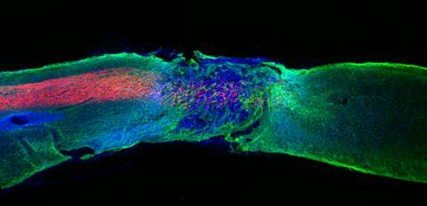 Regenerated axons in spinal cord lesion