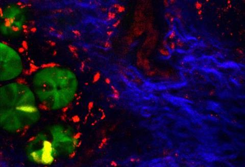 De crypten van de dunne darm, in beeld gebracht met intravitale microscopie. Groen: stamcellen, blauw: collageen, rood: bloed en macrofagen.