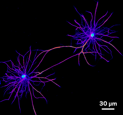 Astrocytes